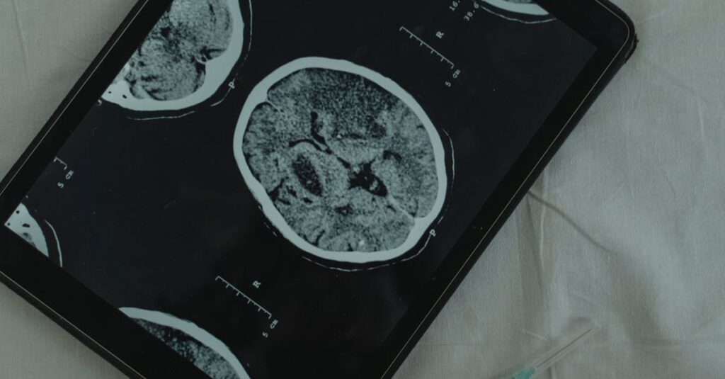 Close-up view of a brain CT scan displayed on a digital tablet with a medical needle beside it.