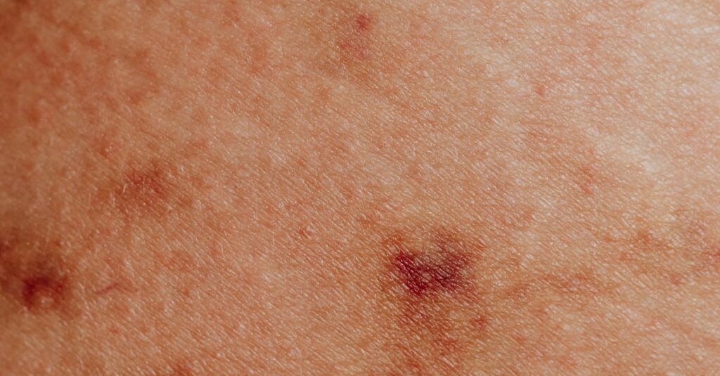 Detailed view of skin with red spots and discoloration, common in dermatology studies.