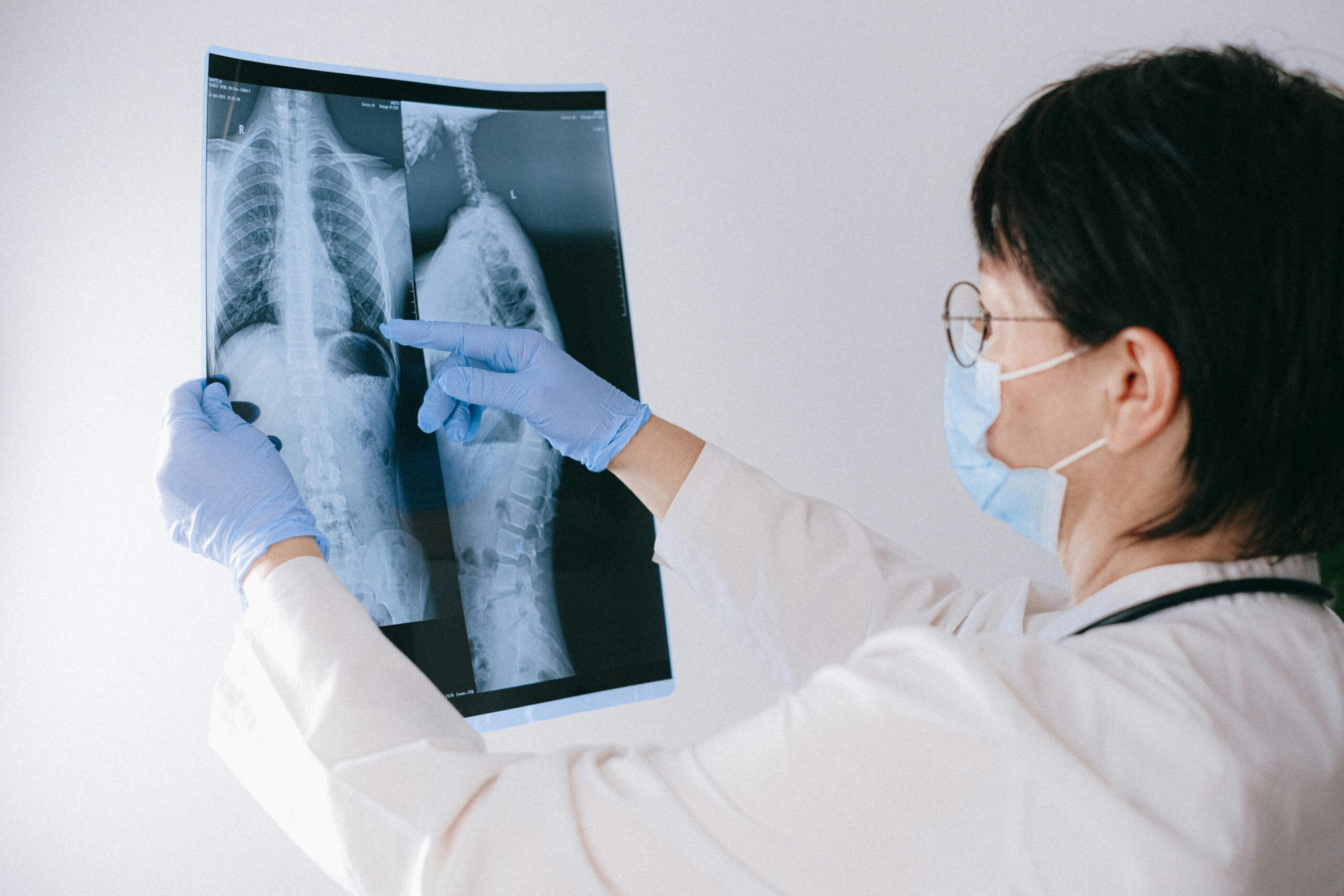 Medical professional reviewing an X-ray, emphasizing healthcare diagnosis and examination.